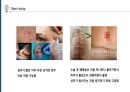상처간호, 배액관 관리, 장루간호 35페이지