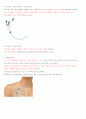 중심정맥관 종류(PICC, chemoport 등) 2페이지