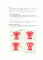 여성간호학(자궁) 간호과정 A+(간호과정, 진단 3가지 상세기술) 4페이지