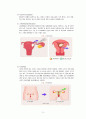 여성간호학(자궁) 간호과정 A+(간호과정, 진단 3가지 상세기술) 7페이지
