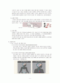 신경외과 간호과정 A+(학술제 발표자료, 간호진단, 과정 2가지 상세기술) 4페이지