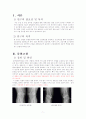 TKA 수술, 성인간호학실습 간호과정 레포트 3페이지