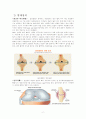 TKA 수술, 성인간호학실습 간호과정 레포트 4페이지