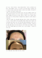 화장품처방학 ) 자신이나 지인의 피부 문제점을 파악해 실제 화장품 처방(토너, 세럼, 크림등)을 통해 변화되는 과정을 논의하시오 5페이지