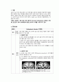 A++자료입니다)정신간호학 실습, 조현병 케이스, 조현병 간호진단 3개/A+보장 2페이지