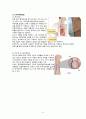 [성인간호실습 A+] CRF 만성신부전 케이스, ESRD, 간호과정, 체액과다, 감염의 위험, 지식부족 8페이지