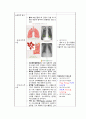 A+받은 Case study, 만성폐쇄성폐질환, COPD, Chronic obstructive pulmonary disease, 성인간호실습케이스, 간호과정, 간호진단 3개 (가스교환장애 외 2개) 5페이지