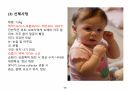 아동간호,아동간호학,아동케이스,아동간호케이스스터디,아동케이스스터디,중이염,중이염케이스 13페이지