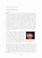 성인실습 A+ 간경변증 케이스 스터디 간호진단4개, 과정4개 2페이지