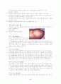 성인실습 A+ 간경변증 케이스 스터디 간호진단4개, 과정4개 5페이지