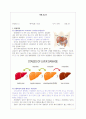 간호학과 케이스스터디 간경화증(간경변증) Liver Cirrhosis 2페이지