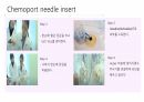 케모포트(Chemoport) 간호 4페이지