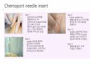 케모포트(Chemoport) 간호 5페이지