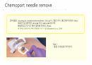 케모포트(Chemoport) 간호 6페이지