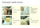 케모포트(Chemoport) 간호 7페이지