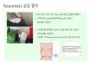 각종배액관관리(헤모박,체스트튜브,PCD,Paracentesis,Ostomy) 30페이지