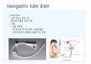 각종배액관관리(헤모박,체스트튜브,PCD,Paracentesis,Ostomy) 36페이지