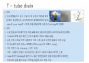 각종배액관관리(헤모박,체스트튜브,PCD,Paracentesis,Ostomy) 41페이지