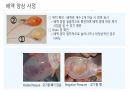 각종배액관관리(헤모박,체스트튜브,PCD,Paracentesis,Ostomy) 5페이지