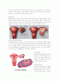 A+받은 난소낭종 케이스 스터디입니다. 진단4개 과정1개 3페이지