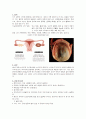 A+받은 여성간호학 난소낭종 케이스입니다. 진단5개 과정2개 입니다. 2페이지