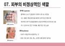 건강사정 - 피부계통 PPT 자료 A+ 12페이지