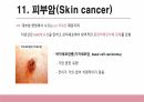 건강사정 - 피부계통 PPT 자료 A+ 18페이지