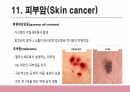 건강사정 - 피부계통 PPT 자료 A+ 19페이지