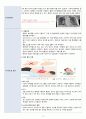 성인간호학실습 - 폐렴 A+ 5페이지