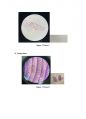Tissue Staining(H&E staining & Sirius red staining) 조직표본제작과 염색 결과 레포트 15페이지