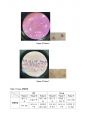 Tissue Staining(H&E staining & Sirius red staining) 조직표본제작과 염색 결과 레포트 16페이지