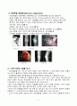 TKR 케이스, 성인간호실습 A+ 케이스 11페이지