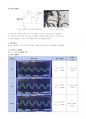 A+받은 다이오드 클램퍼 결과레포트 3페이지