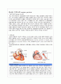 Anginal pectoris(협심증) 간호과정 3페이지