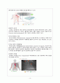 Anginal pectoris(협심증) 간호과정 12페이지