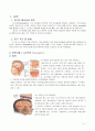 아동 뇌수막염 2페이지