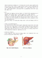 [A+과제] 담관염 Cholangitis 케이스스터디(CASESTUDY) 4페이지