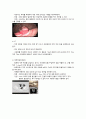 [A+과제][소화기계][케이스스터디][CASESTUDY] 대장암 Colon Cancer 5페이지