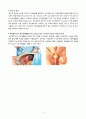 [모성간호학실습] [A+받은과제] 자궁선근증 Adenomyosis CASESTUDY(케이스스터디) 5페이지