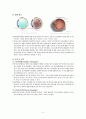 성인간호학_Case study_Vitreous hemorrhage 5페이지