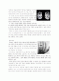 생활과 의료기기 의료기관에서 사용되는 의료기기의 종류(전리, 비전리 모두 포함)와 특징, 작동원리를 인터넷 등에서 찾아서 보고서 형태 4페이지