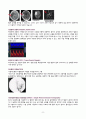 [간호학과 A+] 성인간호학 신경계중환자실 뇌졸중/Cerebral infarction CASE STUDY 8페이지