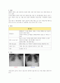 아동간호학실습_간호과정연구보고서 CASE 6페이지