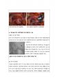 수술실OR 케이스, 뇌동맥결찰술 clipping procedure 6페이지