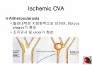 정의위험요소유형자연경과합병증 11페이지