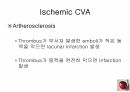 정의위험요소유형자연경과합병증 13페이지