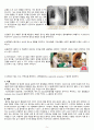 성인간호학 case study+문헌고찰_폐렴 5페이지