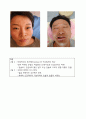 홍채, 얼굴, 혀,  피부, 두피 사진중  하나이상을 선택하여 4컷 이상을 촬영             하여 설명을 달아놓으시오 4페이지