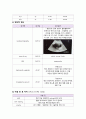 여성간호학 실습 케이스스스터디 자궁근종(uterine myoma) A+ 받은 자료입니다! 문헌고찰부터 대상자 전반적인 자세한 처치, 사정, 경과 등등 기술되어 있으며 간호진단1개, 과정1개가 상세하게 작성한 자료입니다. 10페이지