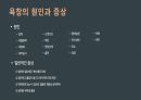 널싱스킬 욕창&관장 발표자료 4페이지